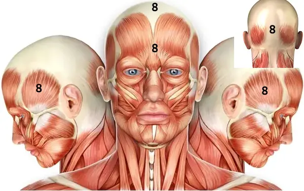 Parkinson
