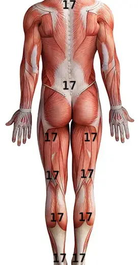 Fibromiyalji